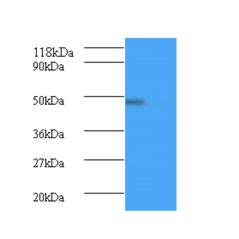 Bone morphogenetic protein 7 Polyclonal Antibody from Signalway Antibody (42441) - Antibodies.com