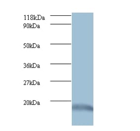 Ubiquitin-like protein ISG15 Polyclonal Antibody from Signalway Antibody (42509) - Antibodies.com