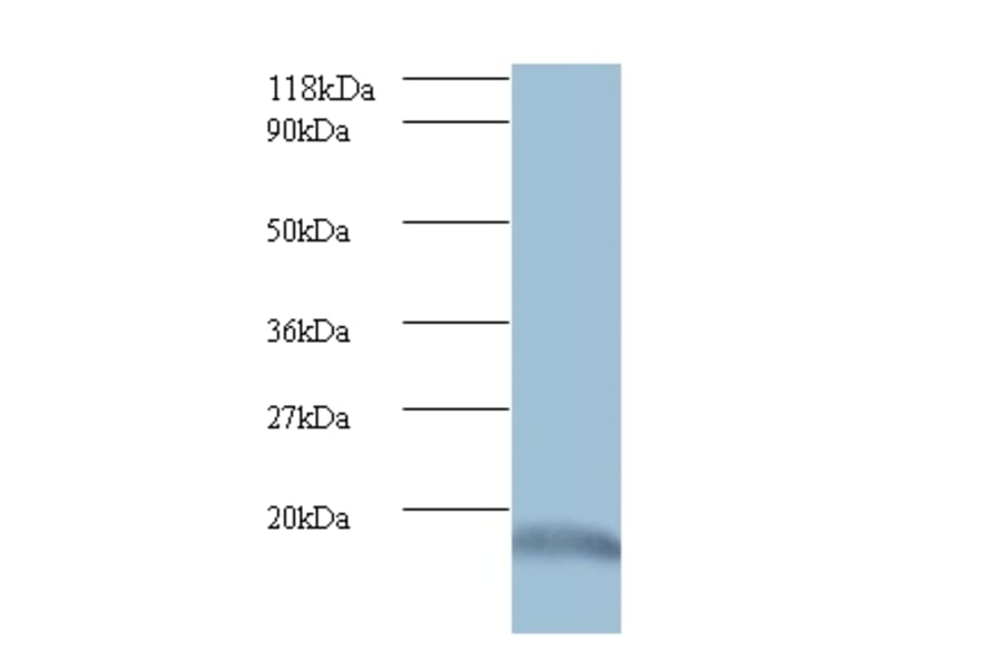 Ubiquitin-like protein ISG15 Polyclonal Antibody from Signalway Antibody (42509) - Antibodies.com