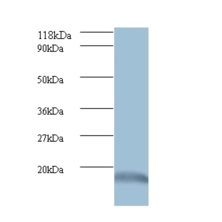Ubiquitin-like protein ISG15 Polyclonal Antibody from Signalway Antibody (42509) - Antibodies.com