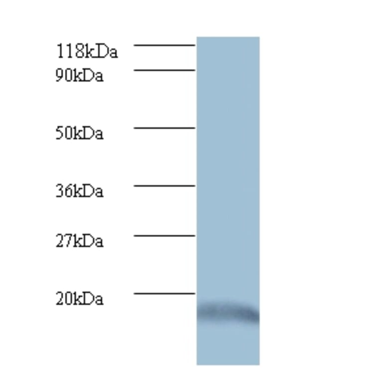 Ubiquitin-like protein ISG15 Polyclonal Antibody from Signalway Antibody (42509) - Antibodies.com