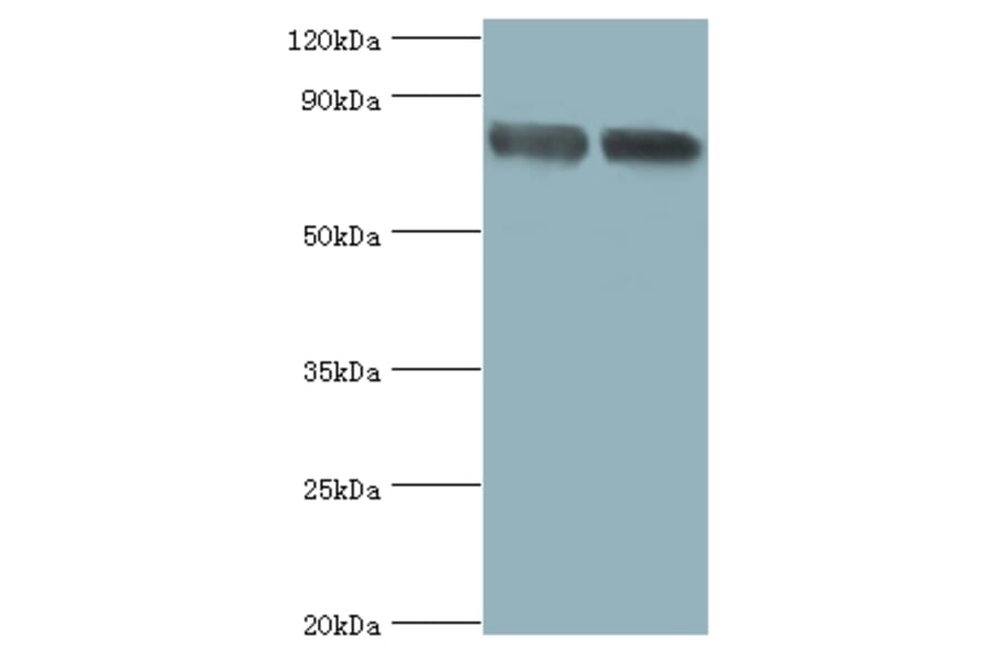 Glutamate carboxypeptidase 2 Polyclonal Antibody from Signalway Antibody (42546) - Antibodies.com