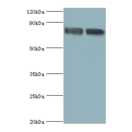 Glutamate carboxypeptidase 2 Polyclonal Antibody from Signalway Antibody (42546) - Antibodies.com