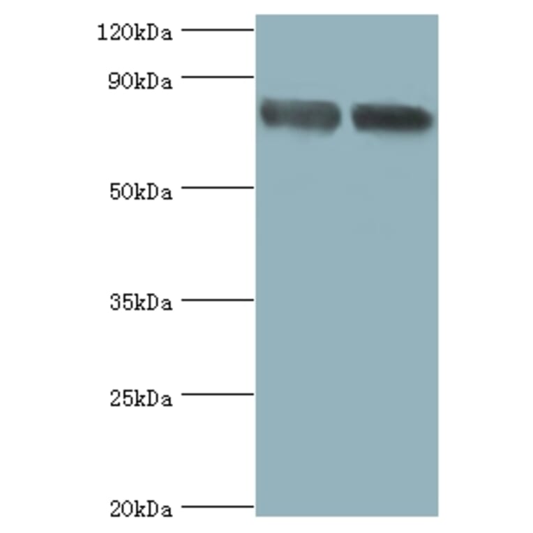 Glutamate carboxypeptidase 2 Polyclonal Antibody from Signalway Antibody (42546) - Antibodies.com