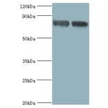 Glutamate carboxypeptidase 2 Polyclonal Antibody from Signalway Antibody (42546) - Antibodies.com