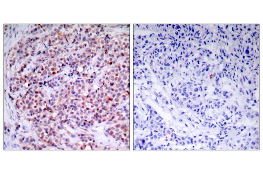 Immunohistochemistry - NFkB-p65 (Ab-435) Antibody from Signalway Antibody (21012) - Antibodies.com