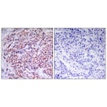 Immunohistochemistry - NFkB-p65 (Ab-435) Antibody from Signalway Antibody (21012) - Antibodies.com