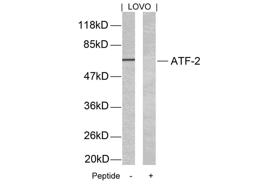 Western blot - ATF2 (Ab-69 or 51) Antibody from Signalway Antibody (21030) - Antibodies.com