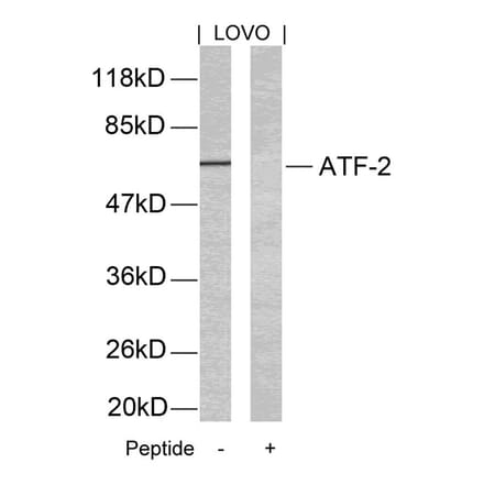 Western blot - ATF2 (Ab-69 or 51) Antibody from Signalway Antibody (21030) - Antibodies.com