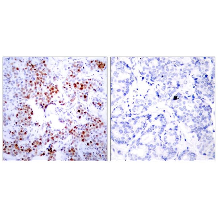 Immunohistochemistry - ATF2 (Ab-69 or 51) Antibody from Signalway Antibody (21030) - Antibodies.com