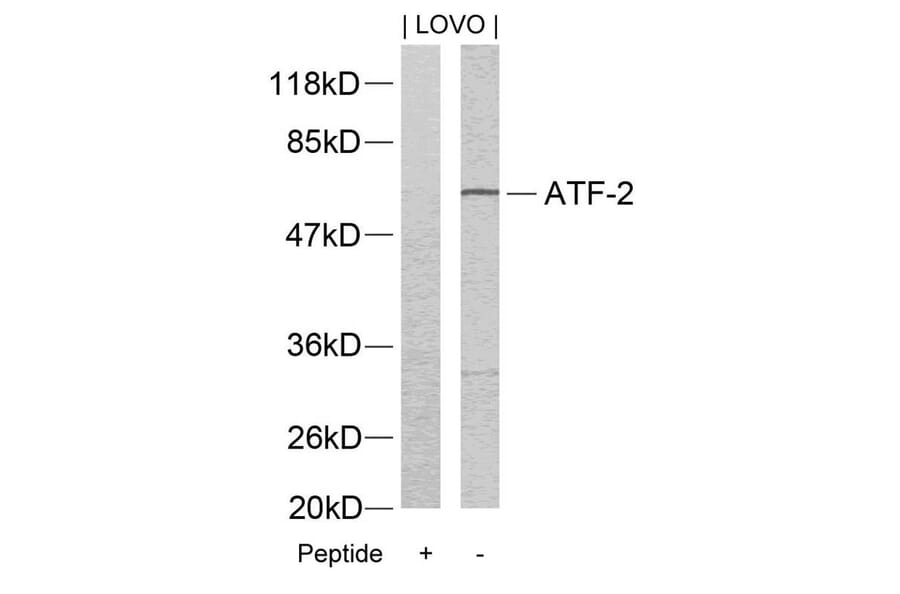 Western blot - ATF2 (Ab-73 or 55) Antibody from Signalway Antibody (21032) - Antibodies.com