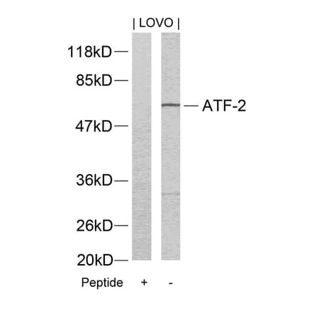 Western blot - ATF2 (Ab-73 or 55) Antibody from Signalway Antibody (21032) - Antibodies.com