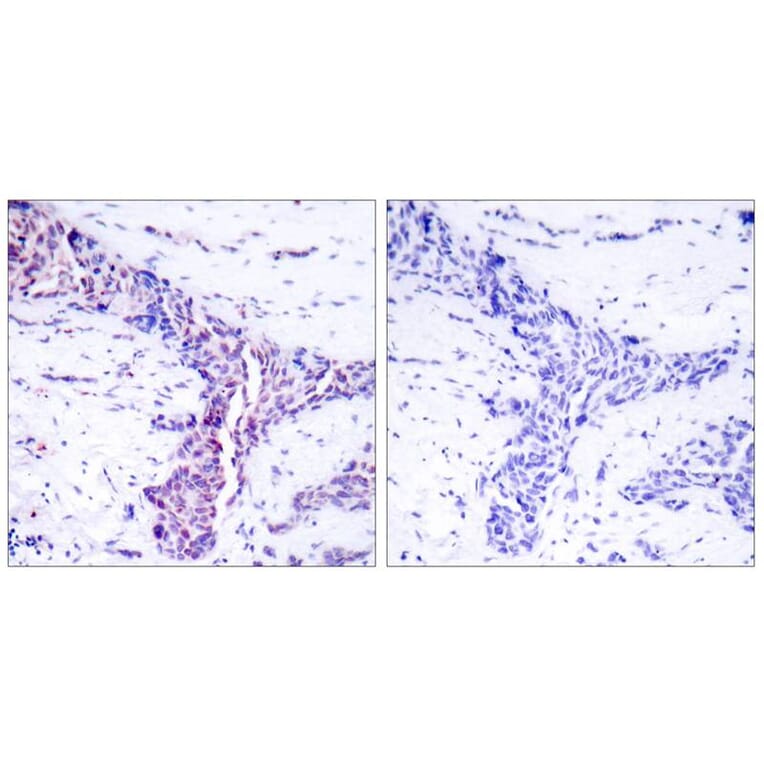 Immunohistochemistry - ATF2 (Ab-73 or 55) Antibody from Signalway Antibody (21032) - Antibodies.com