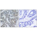 Immunohistochemistry - Stathmin1 (Ab-16) Antibody from Signalway Antibody (21227) - Antibodies.com