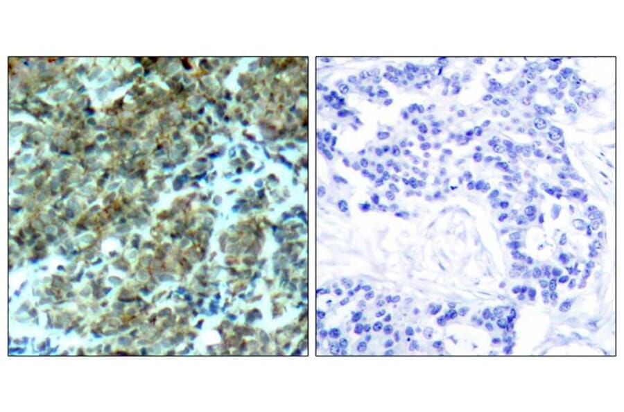 Immunohistochemistry - Cortactin (Ab-466) Antibody from Signalway Antibody (21264) - Antibodies.com