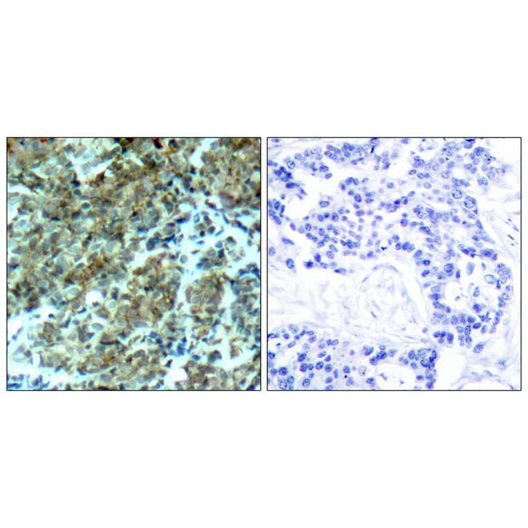 Immunohistochemistry - Cortactin (Ab-466) Antibody from Signalway Antibody (21264) - Antibodies.com
