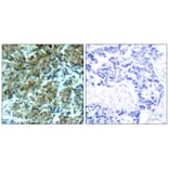 Immunohistochemistry - Cortactin (Ab-466) Antibody from Signalway Antibody (21264) - Antibodies.com