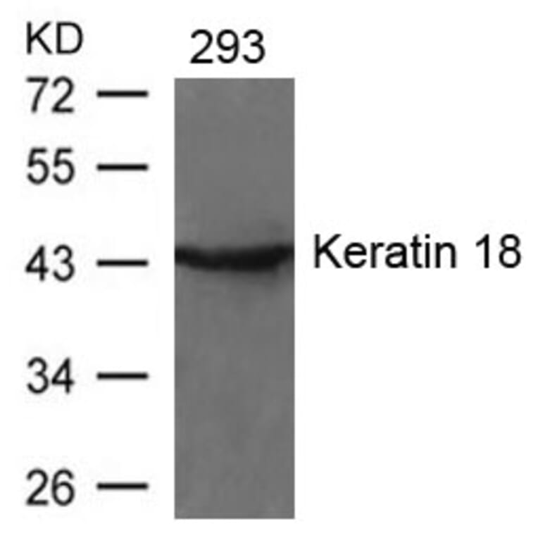 Western blot - Keratin 18 (Ab-33) Antibody from Signalway Antibody (21306) - Antibodies.com