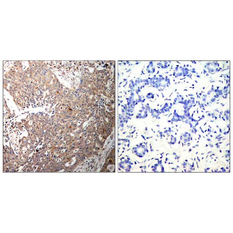 Immunohistochemistry - Keratin 18 (Ab-33) Antibody from Signalway Antibody (21306) - Antibodies.com