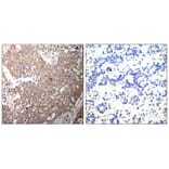 Immunohistochemistry - Keratin 18 (Ab-33) Antibody from Signalway Antibody (21306) - Antibodies.com