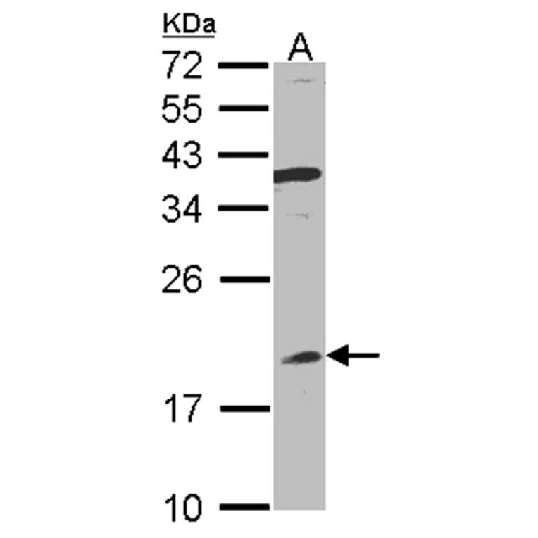 Interferon alpha-8 antibody from Signalway Antibody (22057) - Antibodies.com