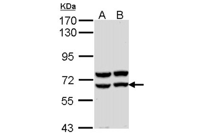 Pancreatic Amylase antibody from Signalway Antibody (22289) - Antibodies.com