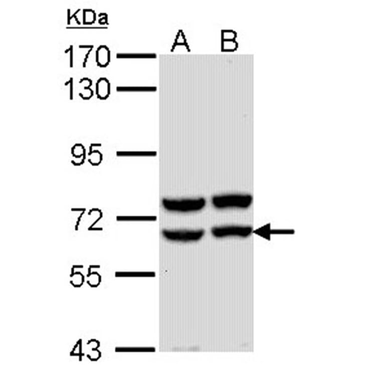 Pancreatic Amylase antibody from Signalway Antibody (22289) - Antibodies.com