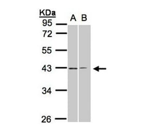 galanin receptor 2 antibody from Signalway Antibody (22464) - Antibodies.com