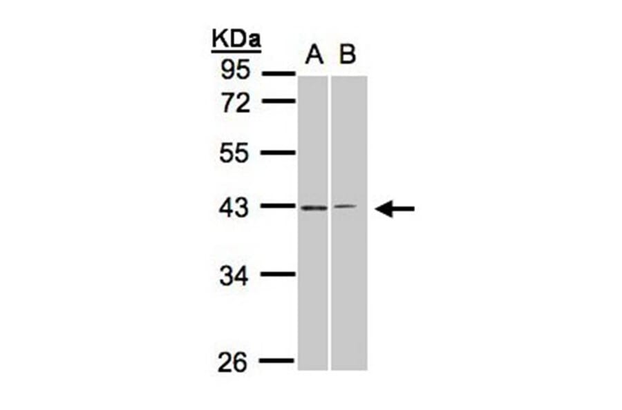 galanin receptor 2 antibody from Signalway Antibody (22464) - Antibodies.com
