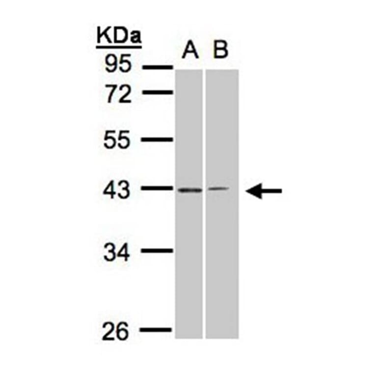 galanin receptor 2 antibody from Signalway Antibody (22464) - Antibodies.com