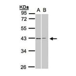 galanin receptor 2 antibody from Signalway Antibody (22464) - Antibodies.com