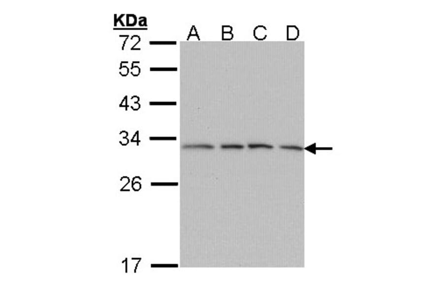 proteasome alpha 7 antibody from Signalway Antibody (23061) - Antibodies.com