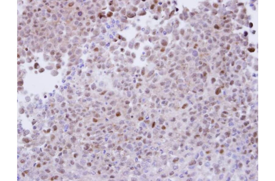 Immunohistochemistry - proteasome alpha 7 antibody from Signalway Antibody (23061) - Antibodies.com