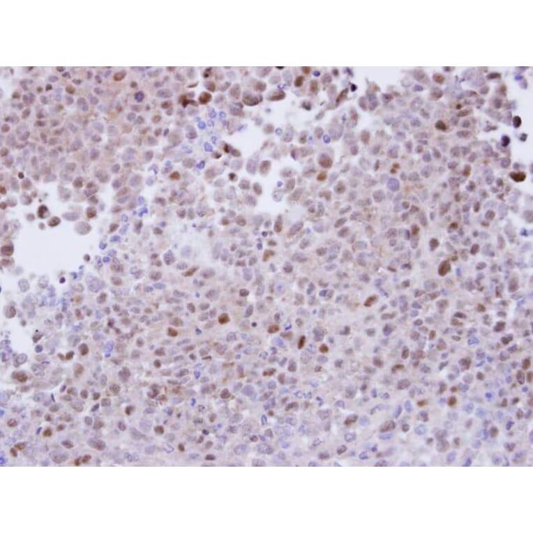 Immunohistochemistry - proteasome alpha 7 antibody from Signalway Antibody (23061) - Antibodies.com