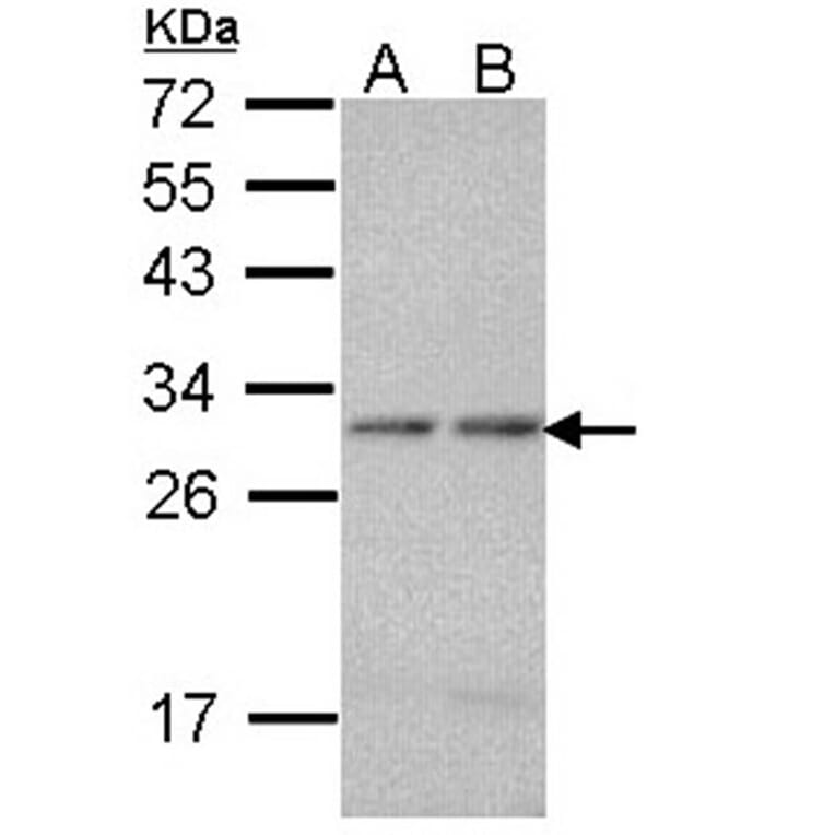 proteasome alpha 7 antibody from Signalway Antibody (23062) - Antibodies.com