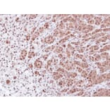 Immunohistochemistry - proteasome alpha 7 antibody from Signalway Antibody (23062) - Antibodies.com