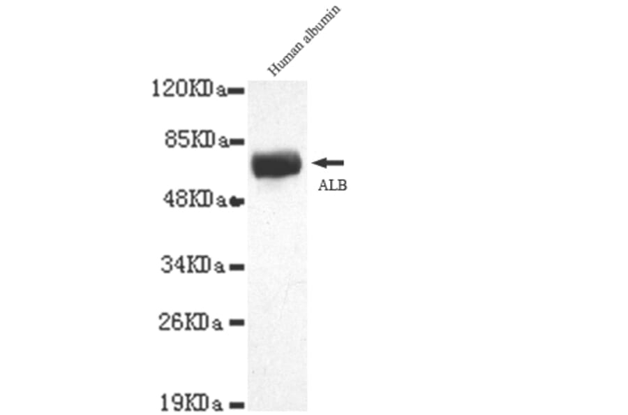 Albumin Monoclonal Antibody from Signalway Antibody (27044) - Antibodies.com