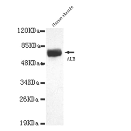 Albumin Monoclonal Antibody from Signalway Antibody (27044) - Antibodies.com