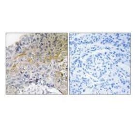 Immunohistochemistry - p130 Cas (Ab-410) Antibody from Signalway Antibody (33124) - Antibodies.com