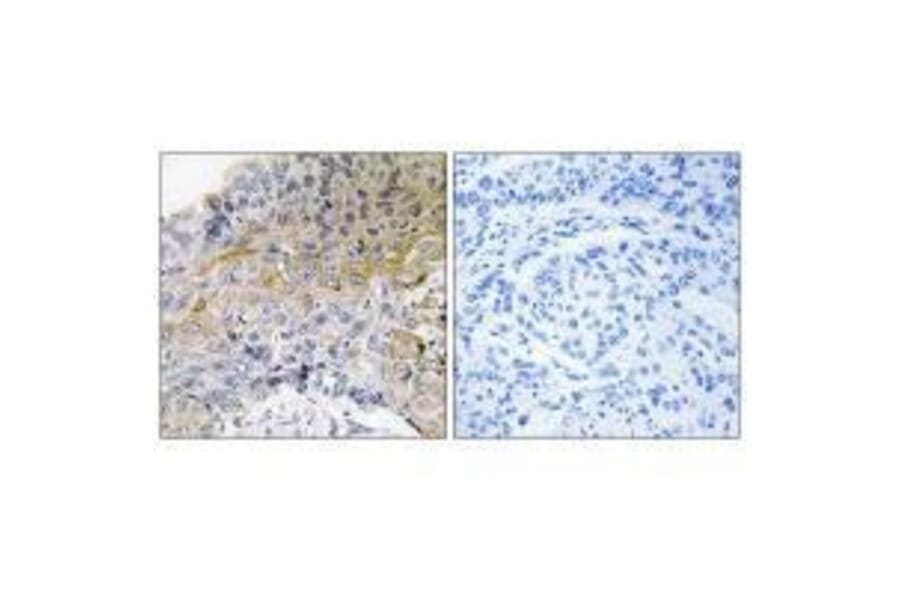 Immunohistochemistry - p130 Cas (Ab-410) Antibody from Signalway Antibody (33124) - Antibodies.com