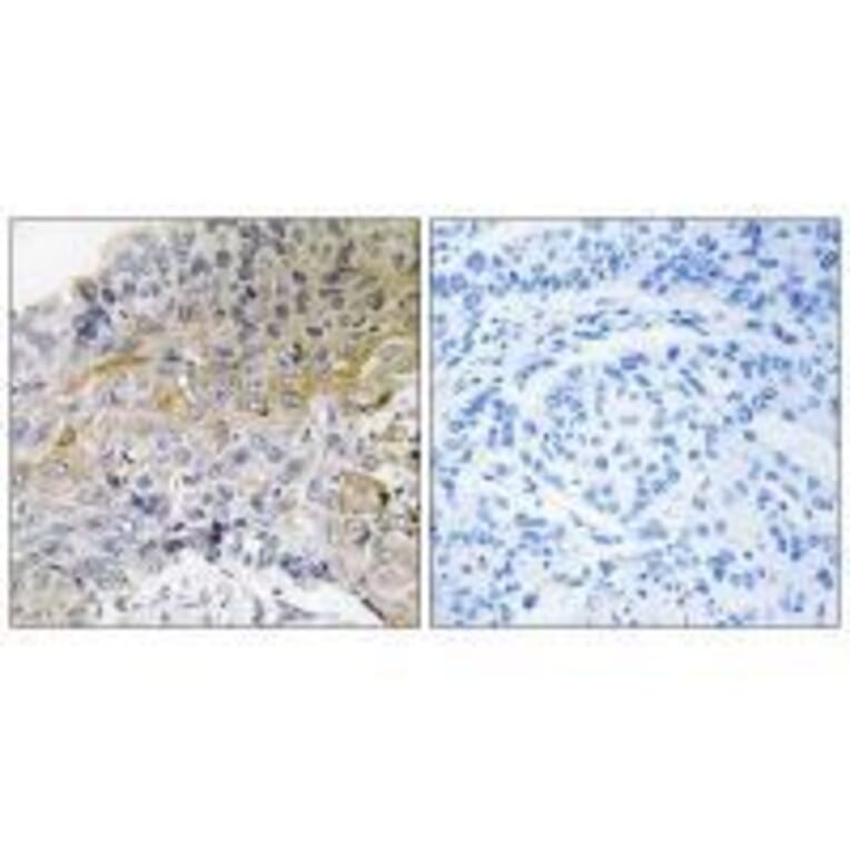 Immunohistochemistry - p130 Cas (Ab-410) Antibody from Signalway Antibody (33124) - Antibodies.com