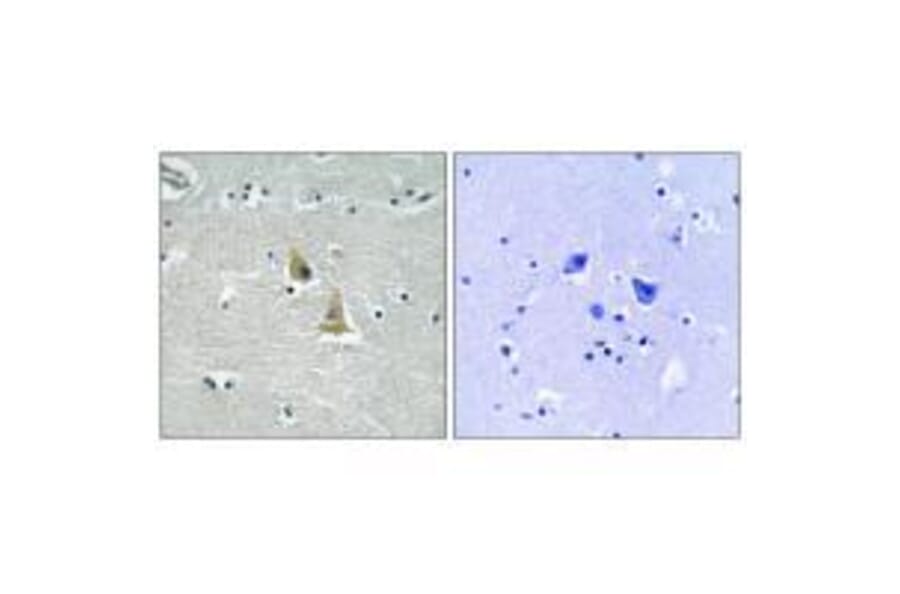 Immunohistochemistry - p47 phox (Ab-345) Antibody from Signalway Antibody (33293) - Antibodies.com
