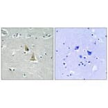 Immunohistochemistry - p47 phox (Ab-345) Antibody from Signalway Antibody (33293) - Antibodies.com