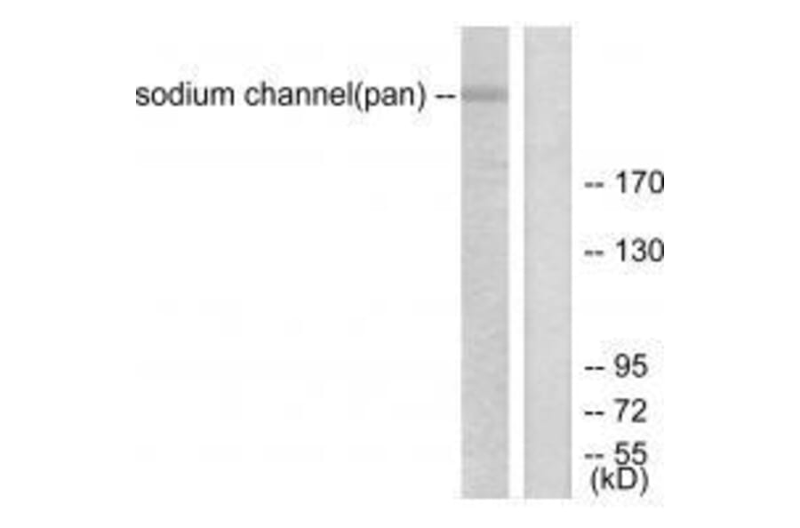 Western blot - Sodium Channel-pan Antibody from Signalway Antibody (33488) - Antibodies.com