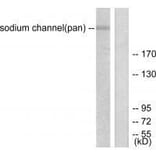 Western blot - Sodium Channel-pan Antibody from Signalway Antibody (33488) - Antibodies.com