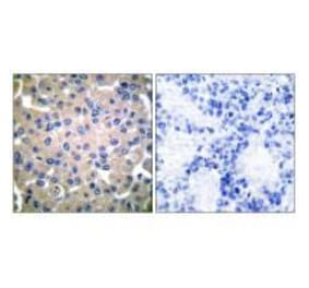 Immunohistochemistry - Transglutaminase 2 Antibody from Signalway Antibody (33505) - Antibodies.com
