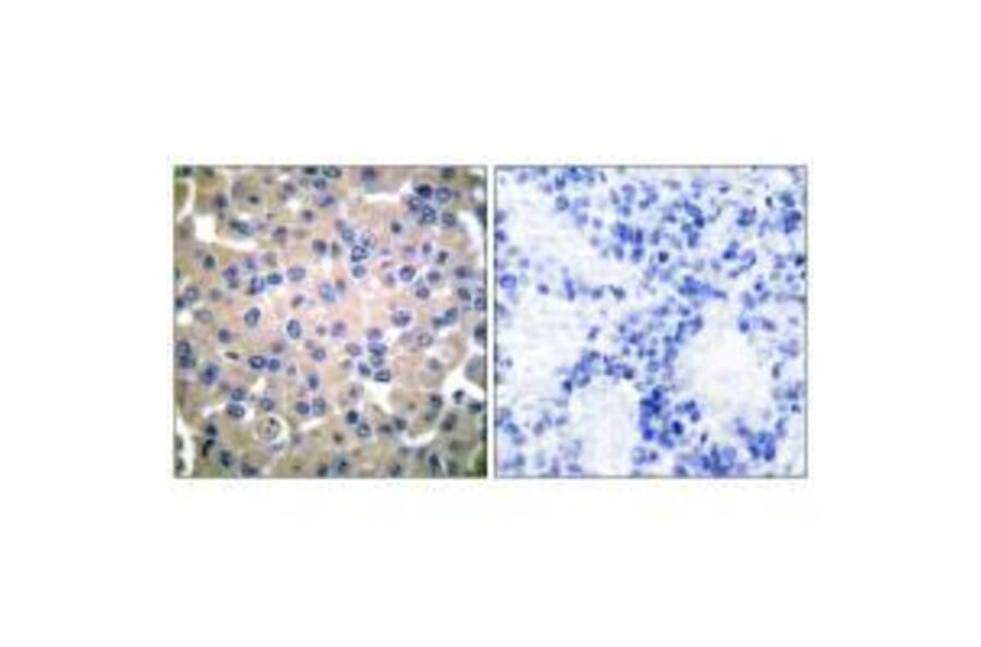 Immunohistochemistry - Transglutaminase 2 Antibody from Signalway Antibody (33505) - Antibodies.com