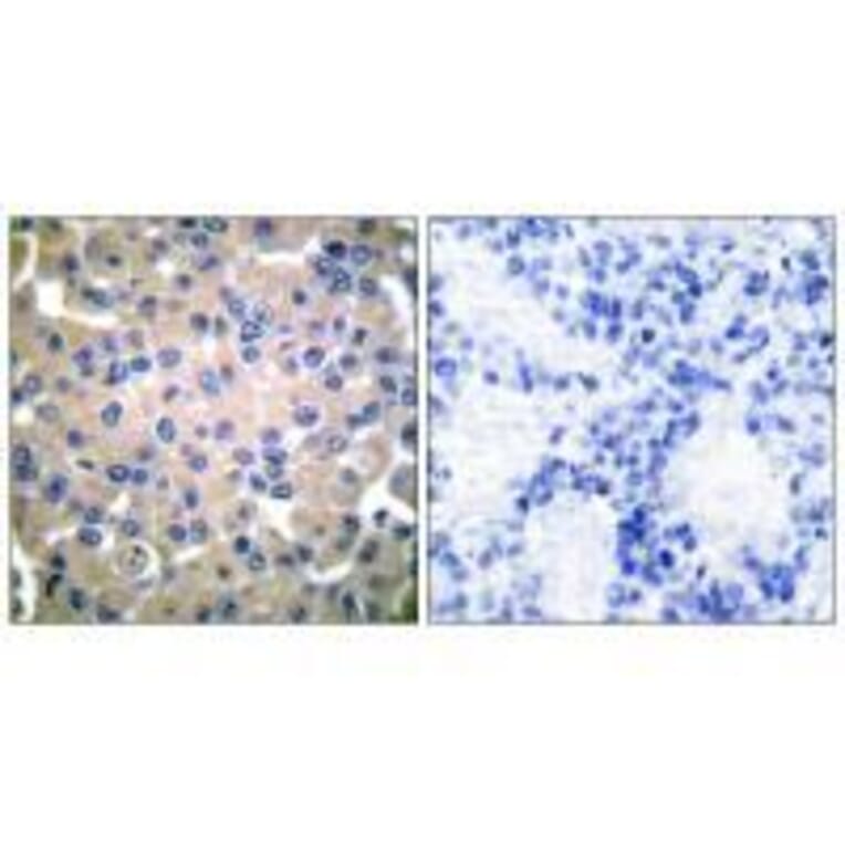 Immunohistochemistry - Transglutaminase 2 Antibody from Signalway Antibody (33505) - Antibodies.com