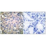 Immunohistochemistry - Transglutaminase 2 Antibody from Signalway Antibody (33505) - Antibodies.com