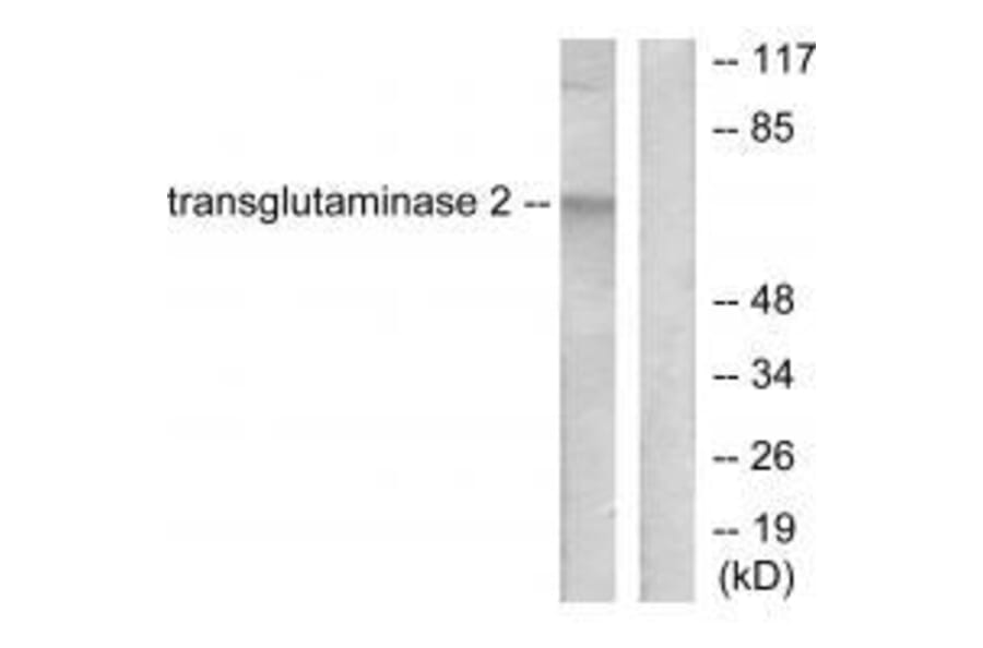 Western blot - Transglutaminase 2 Antibody from Signalway Antibody (33505) - Antibodies.com